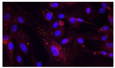 Immunocytochemistry/Immunofluorescence Detection of CD31/PECAM-1 in Porcine SC Cells