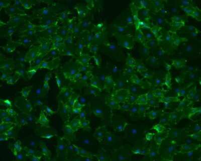 Human Umbilical Vein Endothelial Cells Stained for CD31/PECAM-1