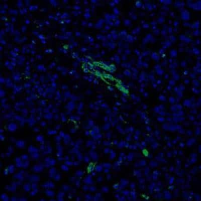 Immunocytochemistry/ Immunofluorescence: CD31/PECAM-1 Antibody - BSA Free [NBP1-71663]