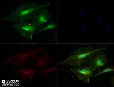 Immunocytochemistry/ Immunofluorescence: CD31/PECAM-1 Antibody - BSA Free [NBP1-71663]