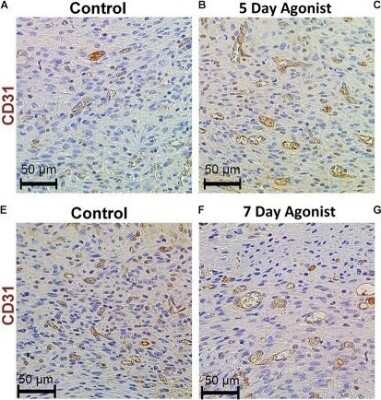 Immunohistochemistry: CD31/PECAM-1 Antibody - BSA Free [NBP1-71663]