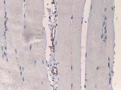 Immunohistological Detection of CD31/PECAM-1 in Paraffin Embedded Rat Muscle