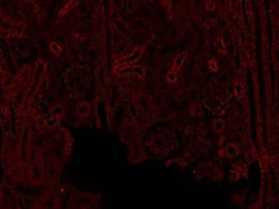 Staining of CD31/PECAM-1 in Paraffin Embedded Canine Bladder Tissue