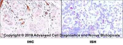 Dual RNAscope ISH-IHC Analysis of CD31/PECAM-1 in Human Tonsil
