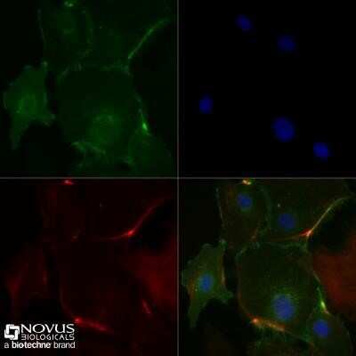 Immunocytochemistry/Immunofluorescence Staining of CD31/PECAM-1 in HUVEC Cells