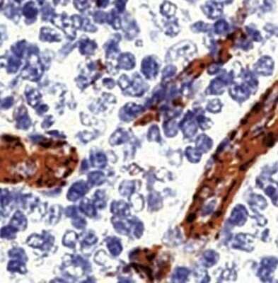 Immunohistological Staining of CD31/PECAM-1 in Paraffin Embedded Human Tonsil