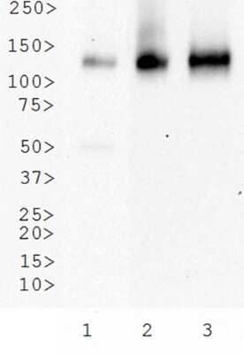 Western Blot Detection of CD31/PECAM-1 in Multiple Cell Lysates