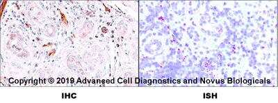 Dual RNAscope ISH-IHC Analysis of CD31/PECAM-1 in Human Tonsil
