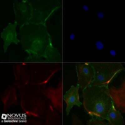 Immunocytochemistry/Immunofluorescence Staining of CD31/PECAM-1 in HUVEC Cells