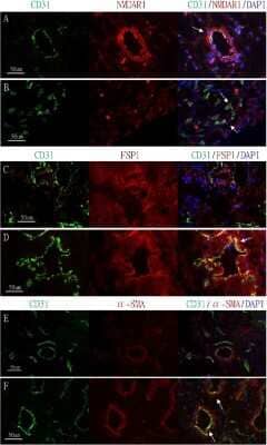 Immunohistological Analysis of CD31/PECAM-1 in Frozen KC and Control Bladder Sections