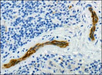 Immunohistological Analysis of CD31/PECAM-1 in Paraffin Embedded Human Spleen