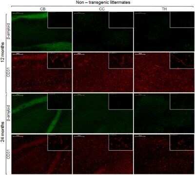 Immunohistochemistry: CD31/PECAM-1 Antibody (MEC 7.46) - Azide and BSA Free [NBP2-80639]