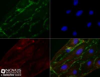 Immunocytochemistry/ Immunofluorescence: CD31/PECAM-1 Antibody (MEC 7.46) [NB100-1642]