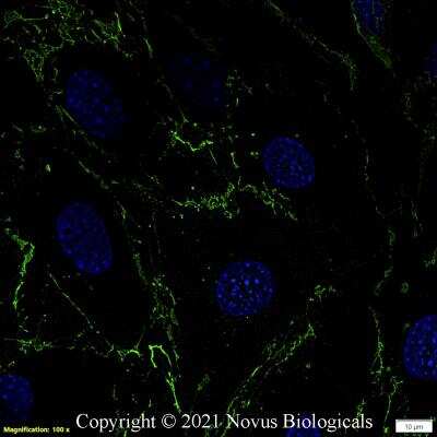 Immunocytochemistry/ Immunofluorescence: CD31/PECAM-1 Antibody (MEC 7.46) [NB100-1642]