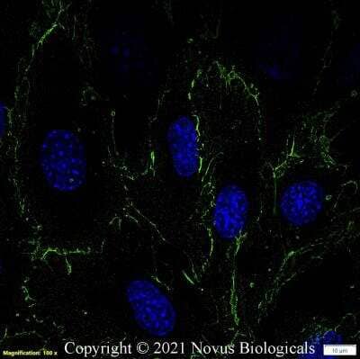 Immunocytochemistry/ Immunofluorescence: CD31/PECAM-1 Antibody (MEC 7.46) [NB100-1642]