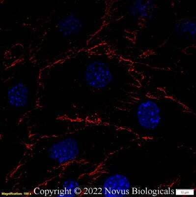 Immunocytochemistry/ Immunofluorescence: CD31/PECAM-1 Antibody (MEC 7.46) [NB100-1642]