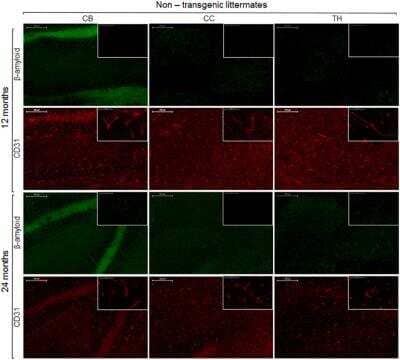 Immunohistochemistry: CD31/PECAM-1 Antibody (MEC 7.46) [NB100-1642]