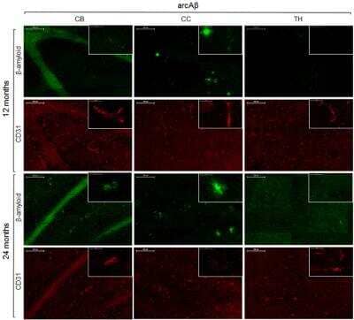 Immunohistochemistry: CD31/PECAM-1 Antibody (MEC 7.46) [NB100-1642]