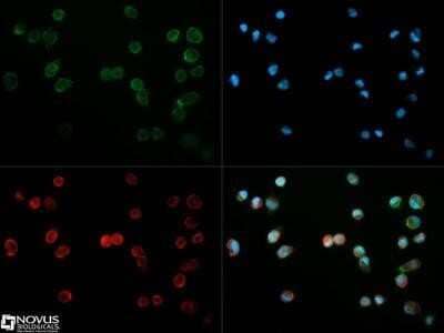 Immunocytochemistry/ Immunofluorescence: CD31/PECAM-1 Antibody (MEC13.3) - Azide and BSA Free [NBP2-80640]