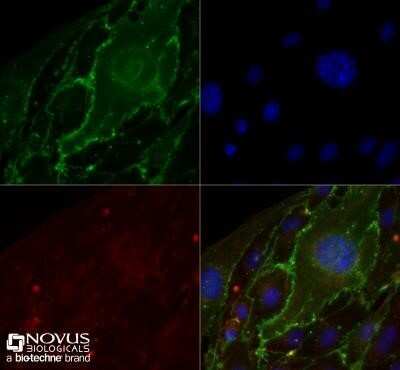 Immunocytochemistry/ Immunofluorescence: CD31/PECAM-1 Antibody (MEC13.3) - Azide and BSA Free [NBP2-80640]
