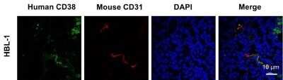 Immunocytochemistry: CD31/PECAM-1 Antibody (MEC13.3) - Azide and BSA Free [NBP2-80640]