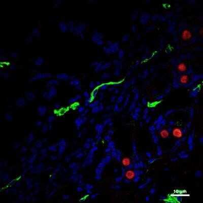 Immunohistochemistry: CD31/PECAM-1 Antibody (MEC13.3) - Azide and BSA Free [NBP2-80640]
