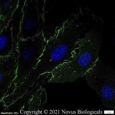 Immunocytochemistry/ Immunofluorescence: CD31/PECAM-1 Antibody (MEC13.3) - BSA Free [NB600-1475]