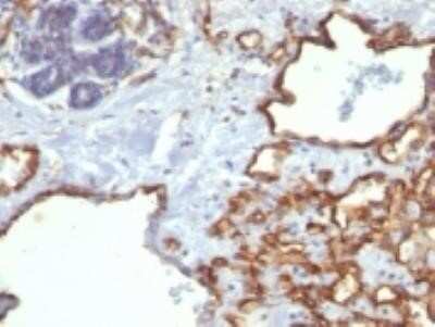 Immunohistochemistry-Paraffin: CD31/PECAM-1 Antibody (SPM122) - Azide and BSA Free [NBP2-34732]