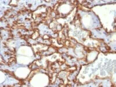 Immunohistochemistry-Paraffin: CD31/PECAM-1 Antibody (SPM532) - Azide and BSA Free [NBP2-34781]