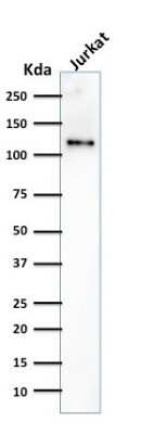 Western Blot: CD31/PECAM-1 Antibody (SPM532) [NBP2-32818]