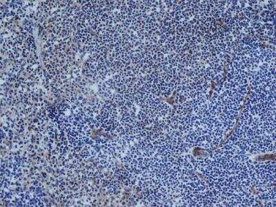 Immunohistochemistry-Frozen: CD31/PECAM-1 Antibody (TLD-3A12) - BSA Free [NB100-64796]