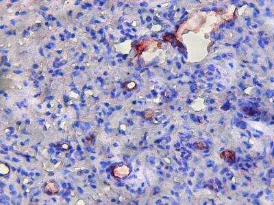 Immunohistochemistry-Paraffin: CD31/PECAM-1 Antibody (TLD-3A12) - BSA Free [NB100-64796]