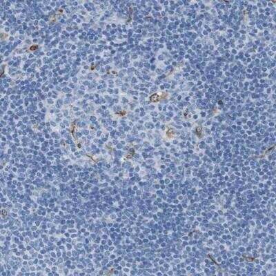 Immunohistochemistry-Paraffin: CD320/TCblR/8D6A Antibody [NBP1-89348]