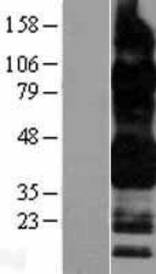 Western Blot: Fc gamma RIIB/CD32b Overexpression Lysate [NBL1-10656]