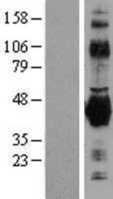 Western Blot: Fc gamma RIIB/CD32b Overexpression Lysate [NBL1-10657]