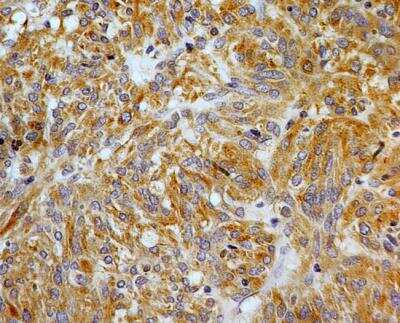 Immunohistochemistry-Paraffin: Siglec-3/CD33 Antibody [NBP2-29619]
