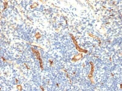 Immunohistochemistry-Paraffin: CD34 Antibody (HPCA1/1171) - Azide and BSA Free [NBP2-47911]