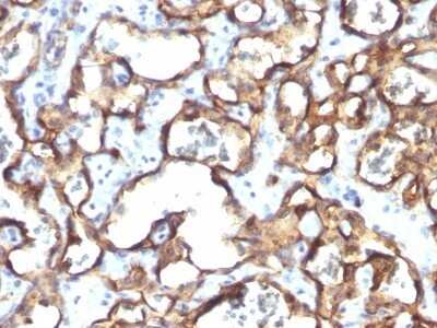 Immunohistochemistry-Paraffin: CD34 Antibody (HPCA1/1171) - Azide and BSA Free [NBP2-47911]