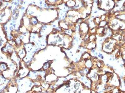 Immunohistochemistry-Paraffin: CD34 Antibody (HPCA1/1171) - IHC-Prediluted [NBP2-48363]