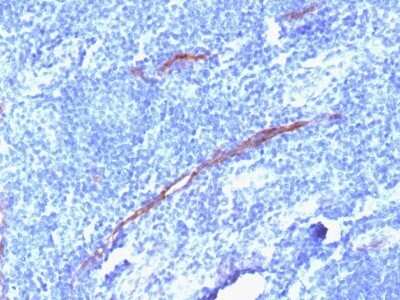 Immunohistochemistry-Paraffin: CD34 Antibody (HPCA1/1806R) - Azide and BSA Free [NBP2-54355]