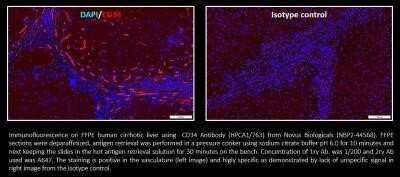 Immunocytochemistry/ Immunofluorescence: CD34 Antibody (HPCA1/763) - Azide and BSA Free [NBP2-47910]