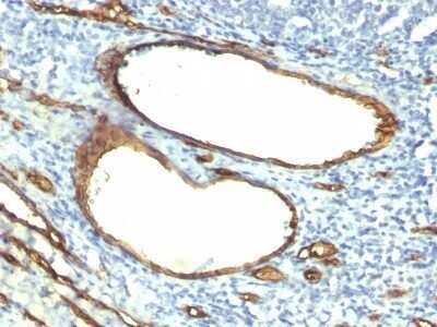 Immunohistochemistry-Paraffin: CD34 Antibody (HPCA1/763) - Azide and BSA Free [NBP2-47910]