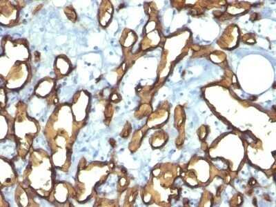Immunohistochemistry-Paraffin: CD34 Antibody (HPCA1/763) - Azide and BSA Free [NBP2-47910]