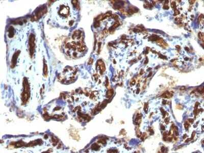 Immunohistochemistry-Paraffin: CD34 Antibody (HPCA1/763) - Azide and BSA Free [NBP2-47910]