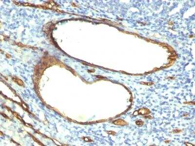 Immunohistochemistry-Paraffin: CD34 Antibody (HPCA1/763) - IHC-Prediluted [NBP2-48332]