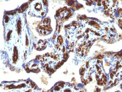 Immunohistochemistry-Paraffin: CD34 Antibody (HPCA1/763) - IHC-Prediluted [NBP2-48332]