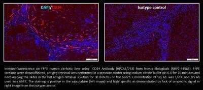 Immunocytochemistry/ Immunofluorescence: CD34 Antibody (HPCA1/763) [NBP2-44568]