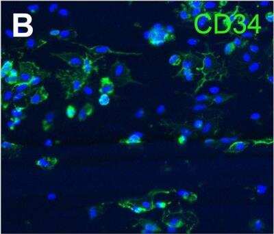 Immunohistochemistry: CD34 Antibody (HPCA1/763) [NBP2-44568]