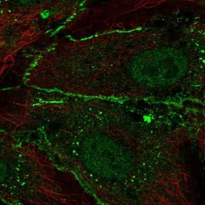 Immunocytochemistry/ Immunofluorescence: CD34 Antibody [NBP2-38322]