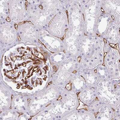 Immunohistochemistry-Paraffin: CD34 Antibody [NBP2-38321]